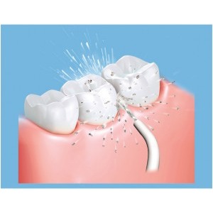 Panasonic Irigator oral EW1411H845, alimentare acumulator, 1400 impulsuri / minut, curatare pungi parodontale