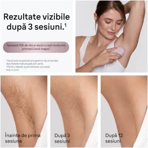 Braun Silk-épil 9 9-061 Wet & Dry